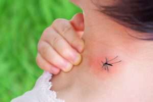 Read more about the article Insect Bite Home Remedies: Skin infection due to insect bite? Get relief from these home remedies 2023